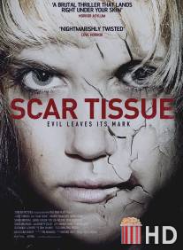Рубцовая ткань / Scar Tissue