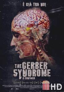 Синдром Гербера / Gerber Syndrome: il contagio, The