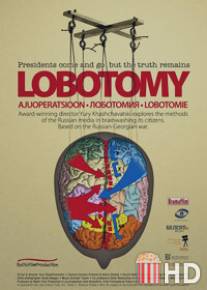 Лоботомия / Lobotomiya